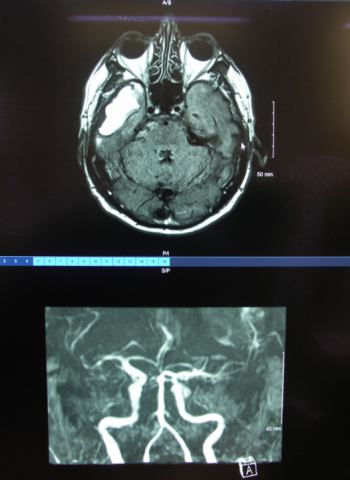 CHAN - imagerie - 001